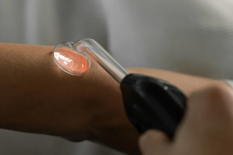 pacem-human-cold-plasma-00010